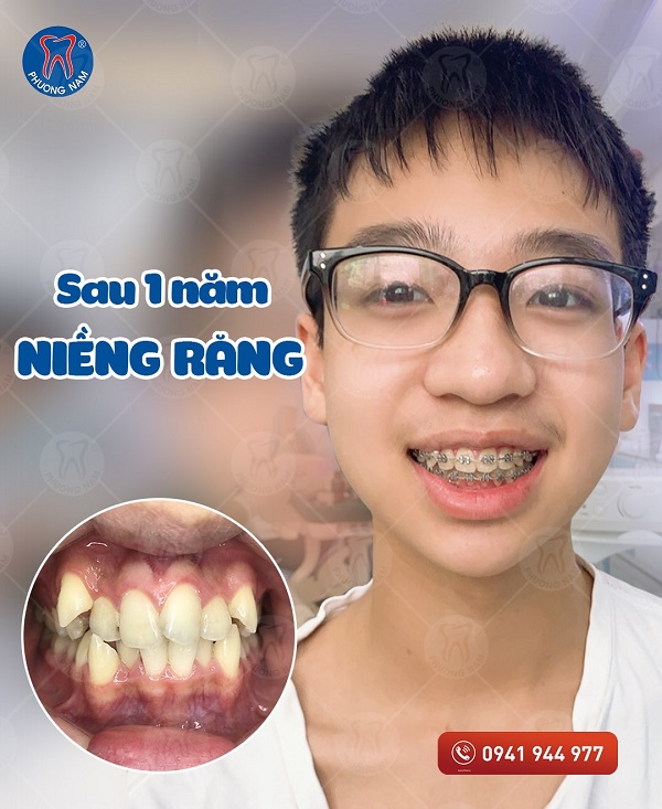 Nha Khoa Phương Nam - Chi nhánh Tuyên Quang ảnh 2