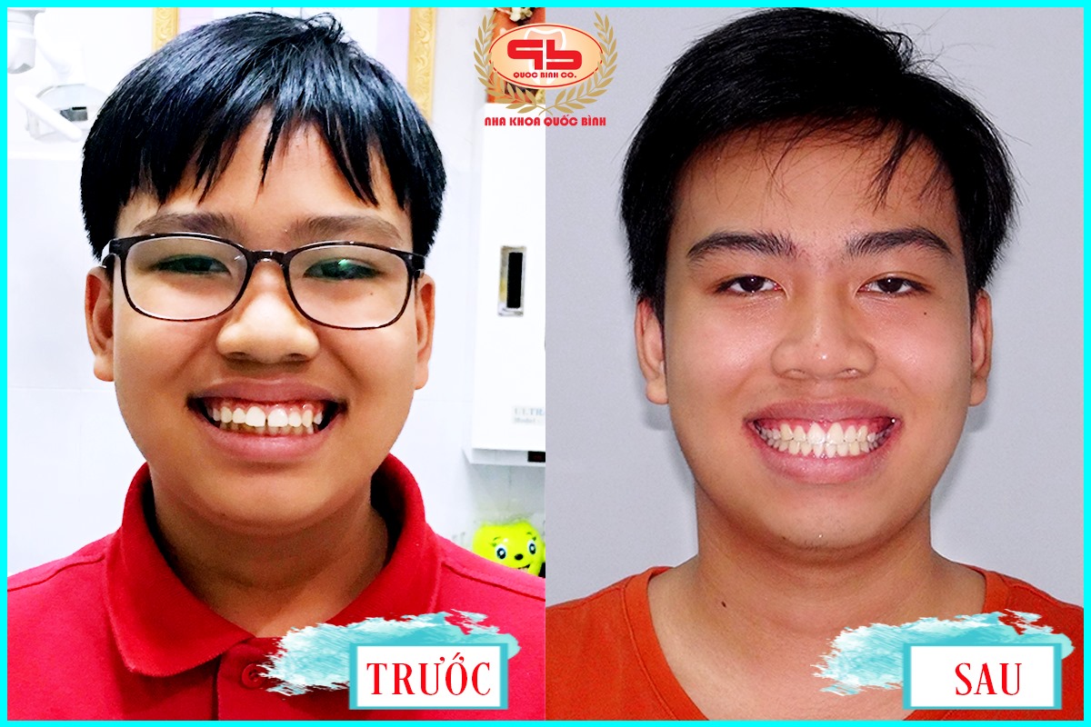 Nha Khoa Quốc Bình Vũng Tàu ảnh 1