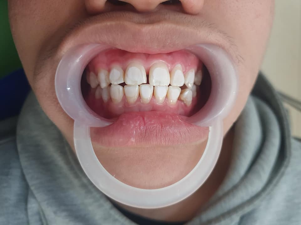 Nha Khoa Quốc Tế For Smile ảnh 2