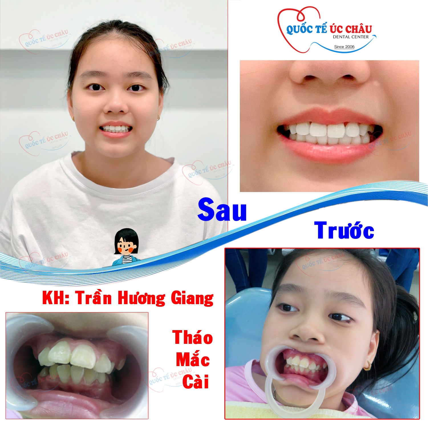 Nha Khoa Quốc Tế Úc Châu ảnh 2