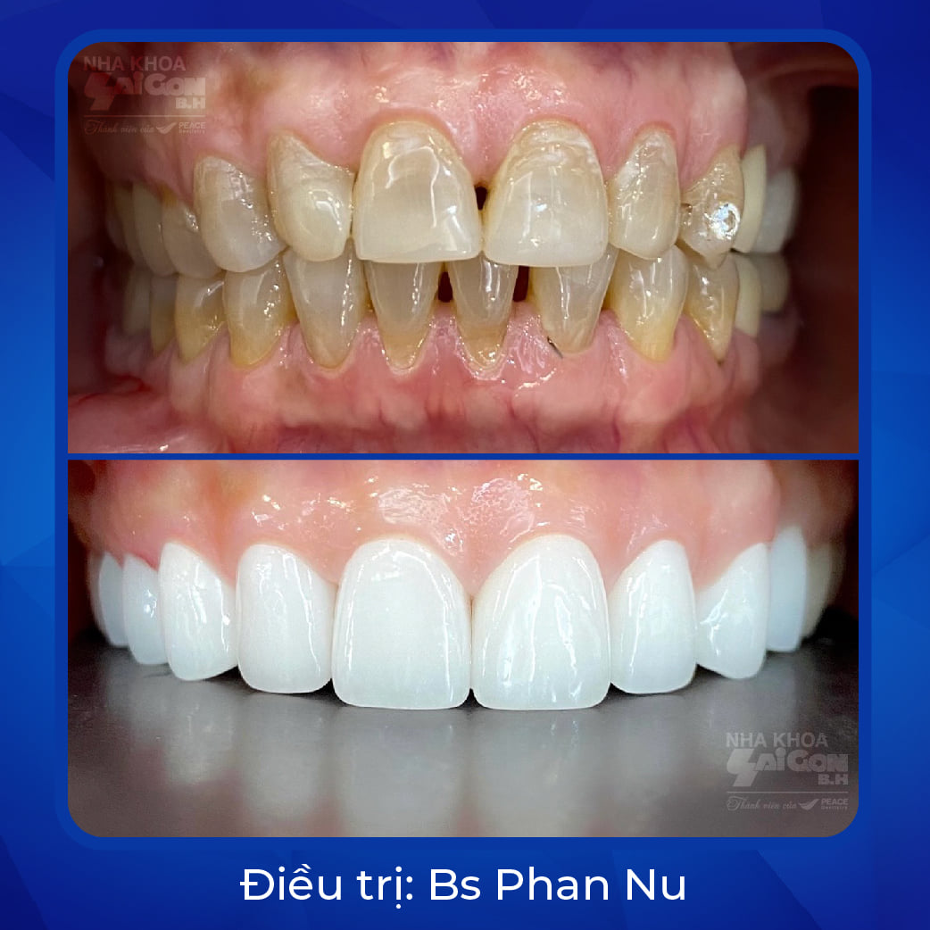 Nha Khoa Sài Gòn B.H - Hố Nai ảnh 1