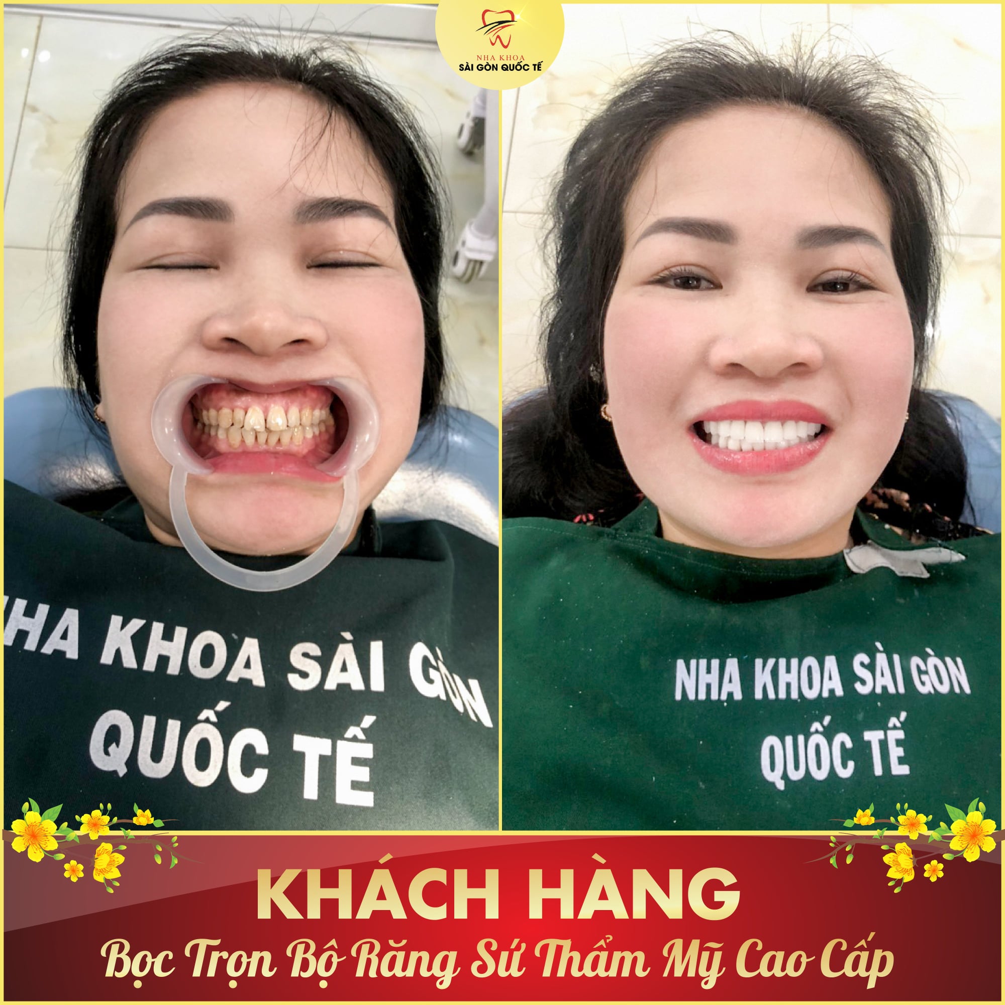 Nha Khoa Sài Gòn Quốc Tế ảnh 2