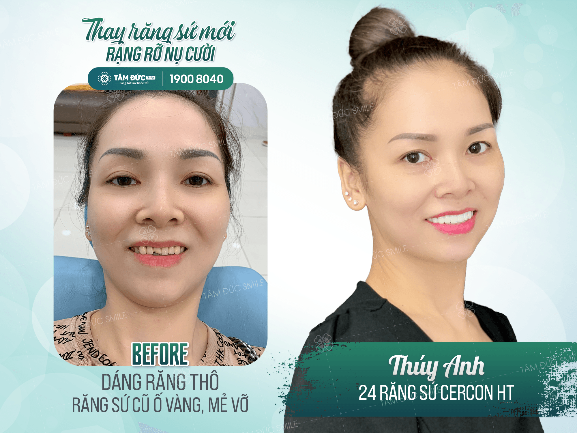 Nha Khoa Tâm Đức Smile ảnh 2