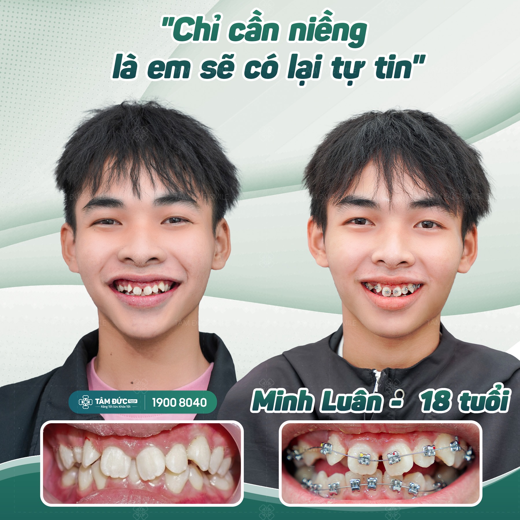 Nha Khoa Tâm Đức Smile- Vũng Tàu ảnh 1