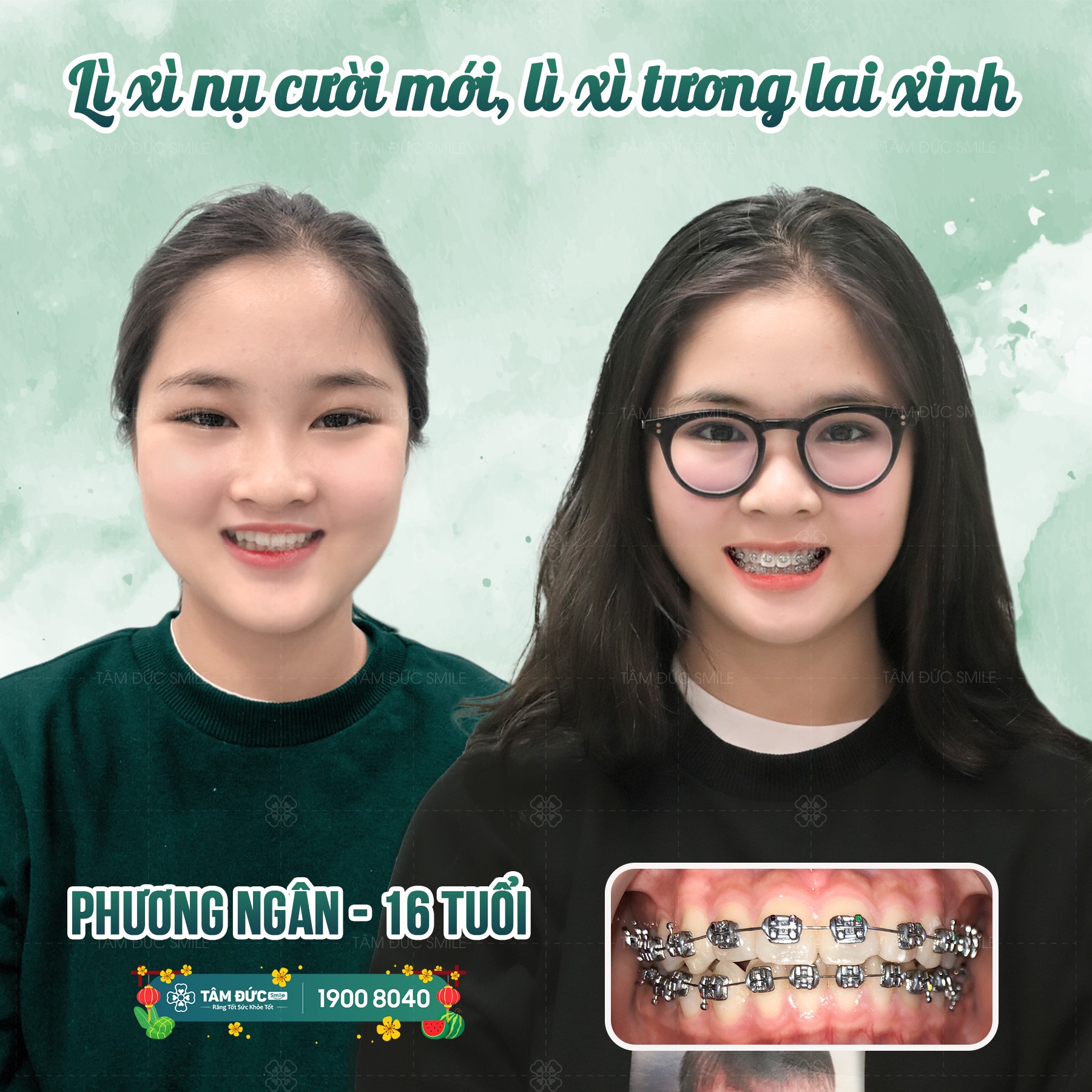 Nha Khoa Tâm Đức Smile- Vũng Tàu ảnh 2