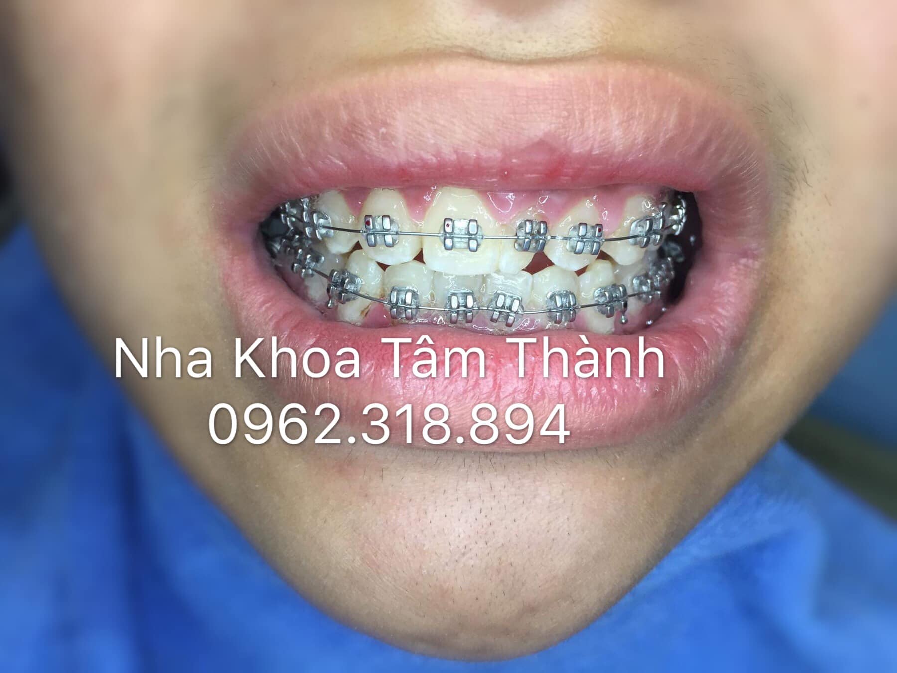 Nha Khoa Tâm Thành Tuyên Quang ảnh 2