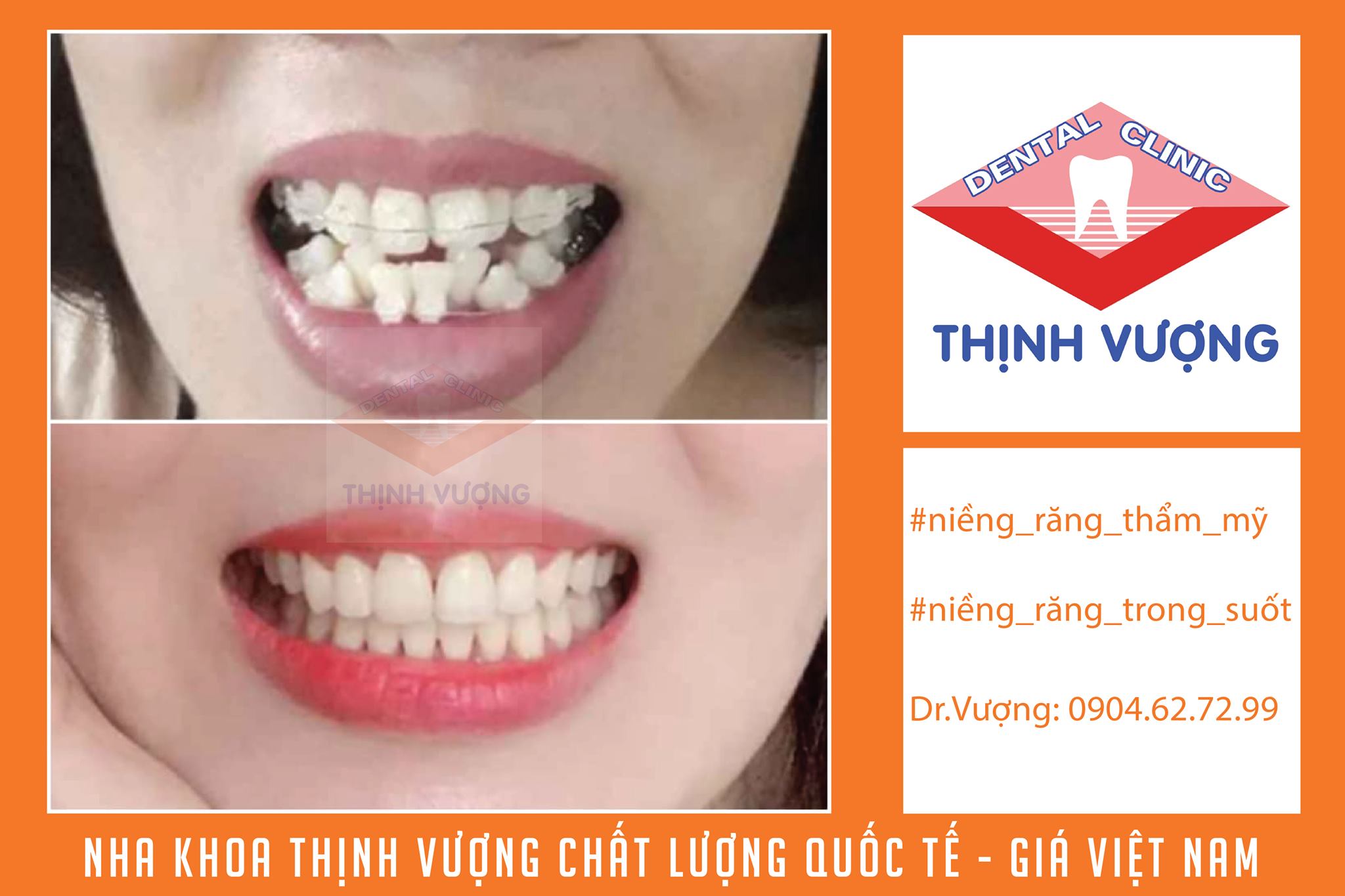 Nha Khoa Thịnh Vượng ảnh 2