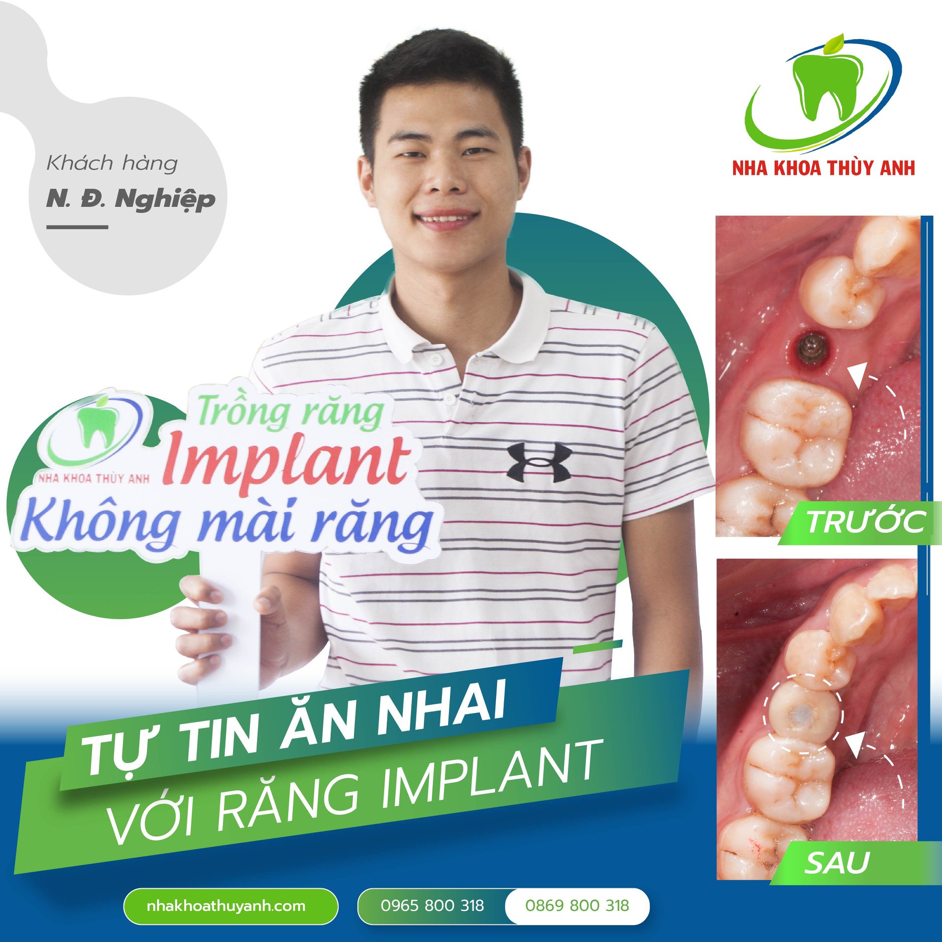 Nha Khoa Thùy Anh ảnh 1