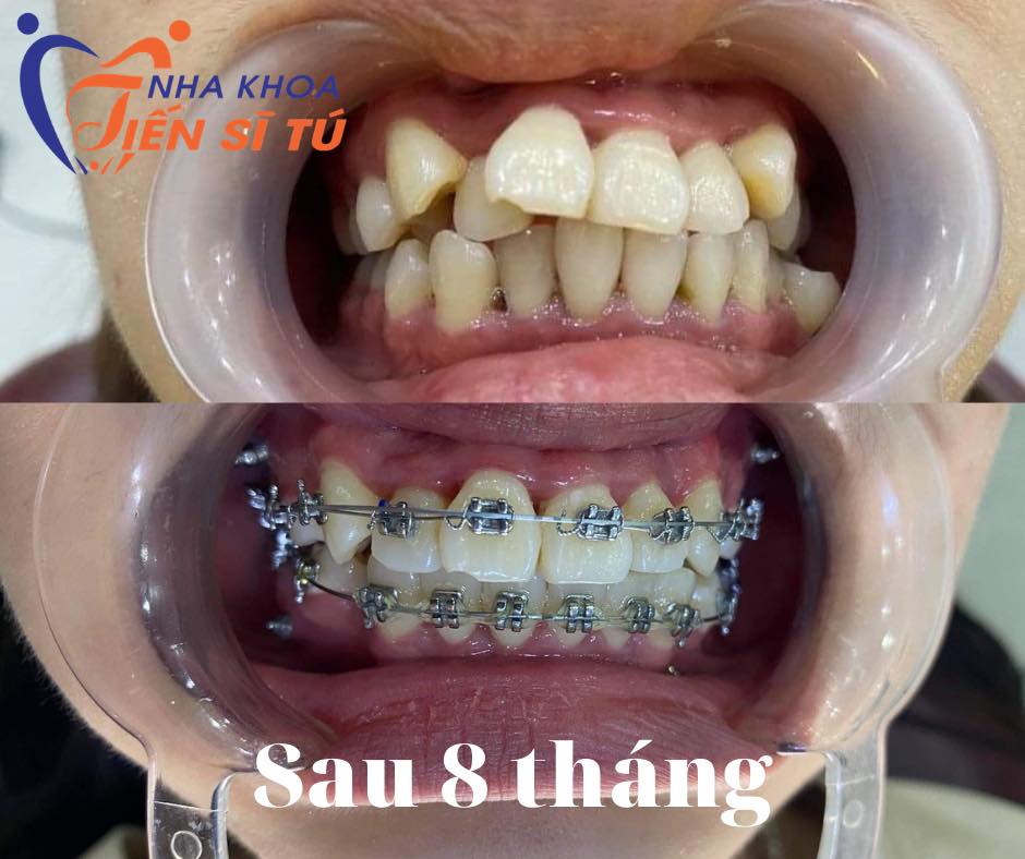 Nha Khoa Tiến Sĩ Tú ảnh 2