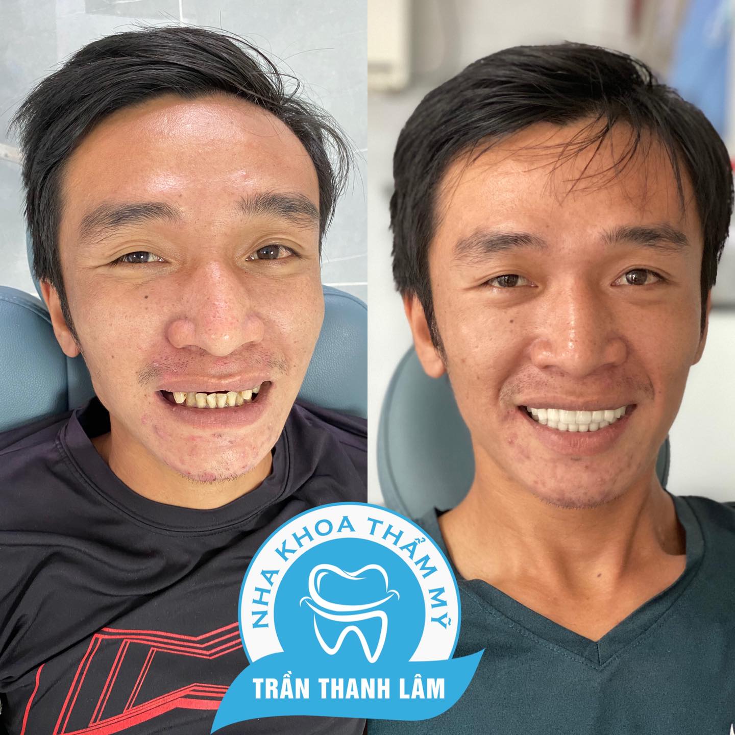 Nha Khoa Trần Thanh Lâm ảnh 1