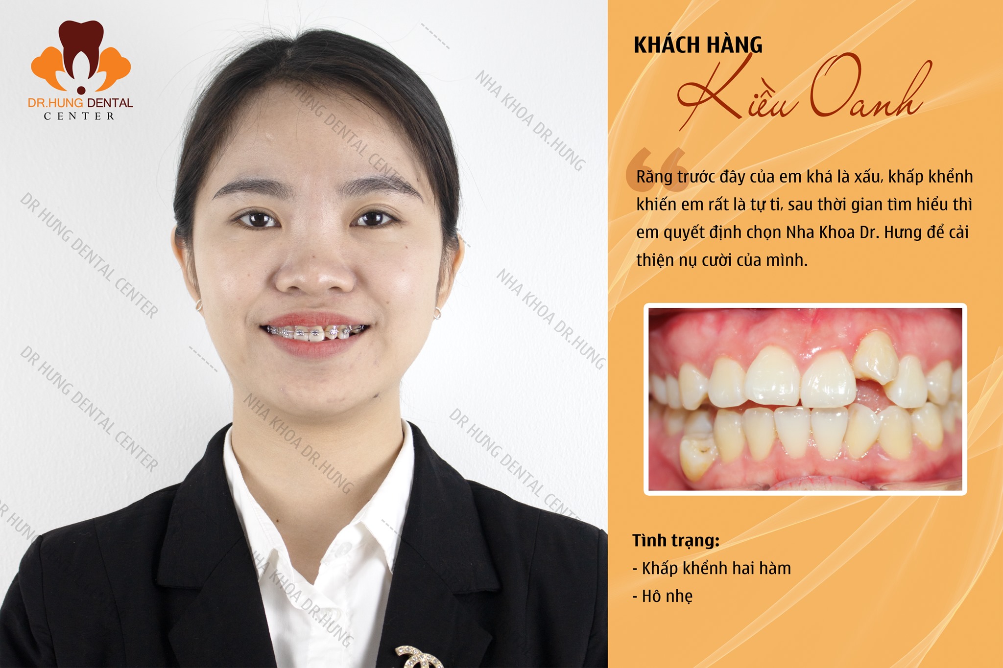 Nha Khoa Trâu Quỳ - Dr Hưng Dental Center ảnh 2