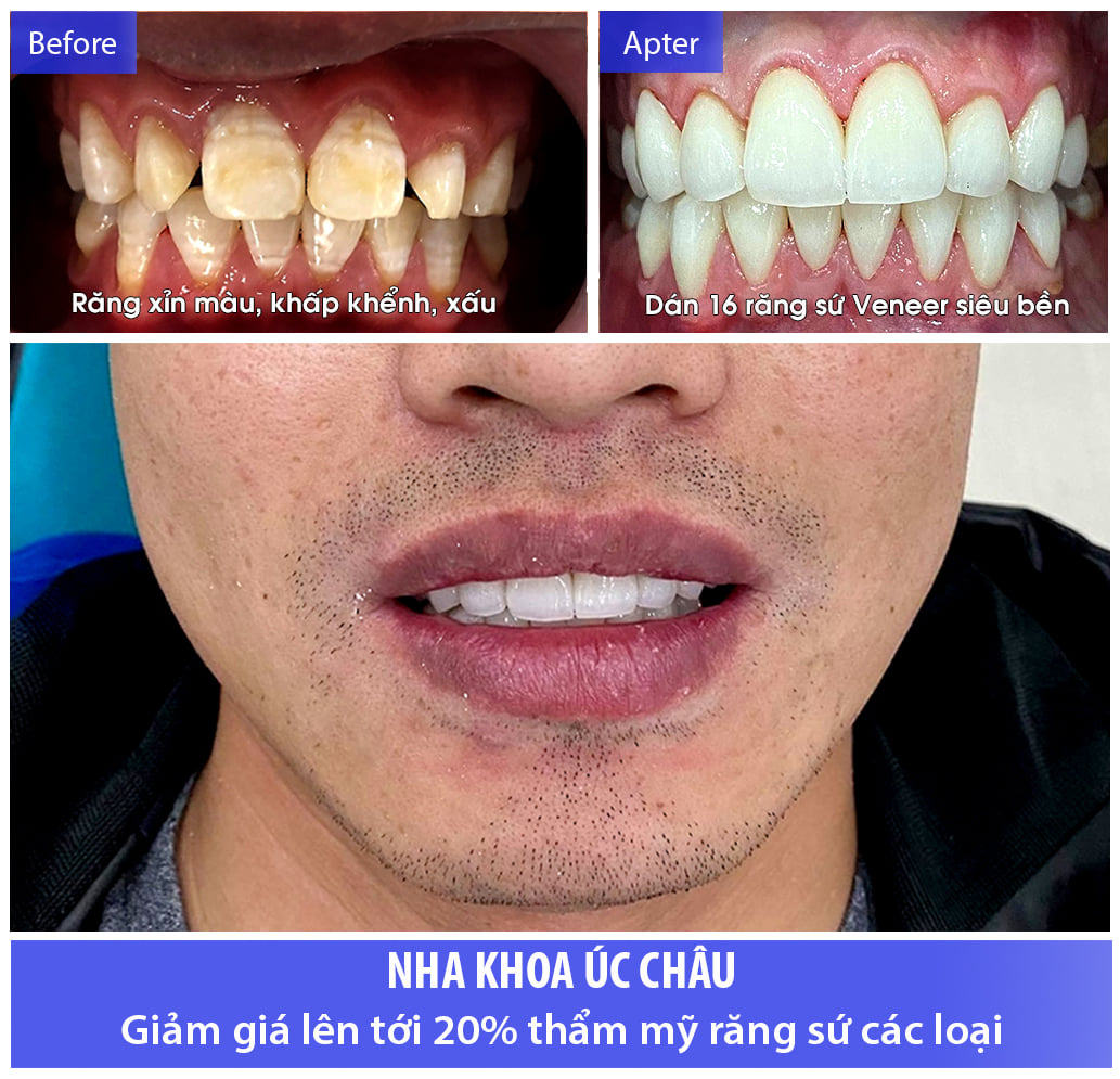 Nha Khoa Úc Châu ảnh 1