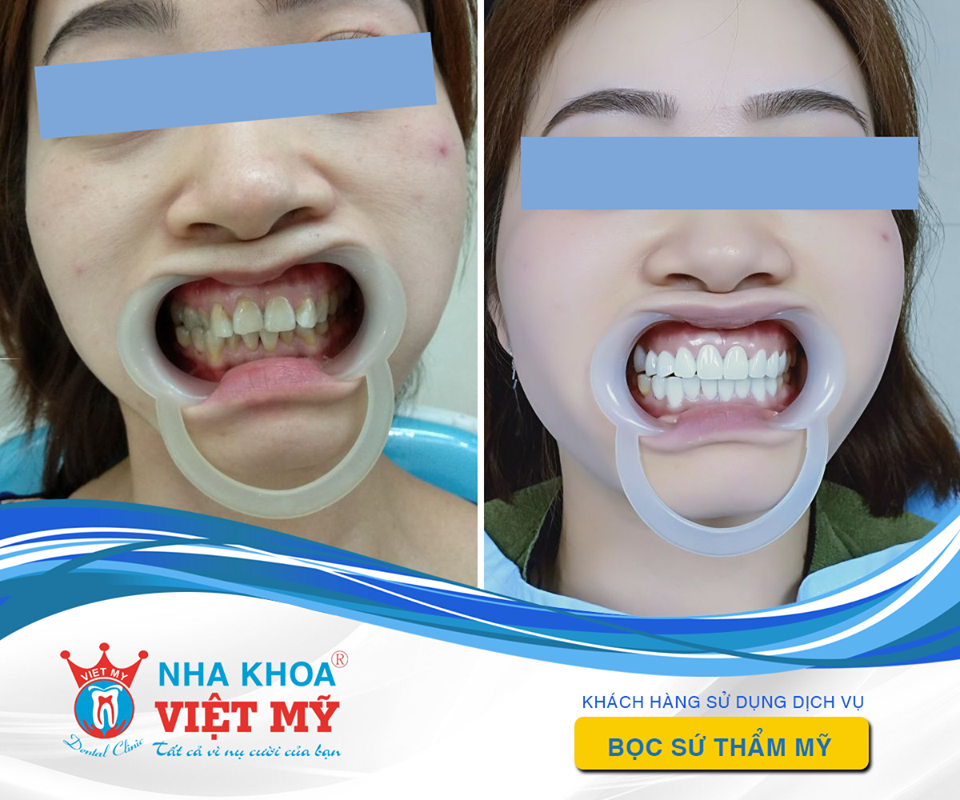 Nha Khoa Việt Mỹ - Tuy Hoà ảnh 1