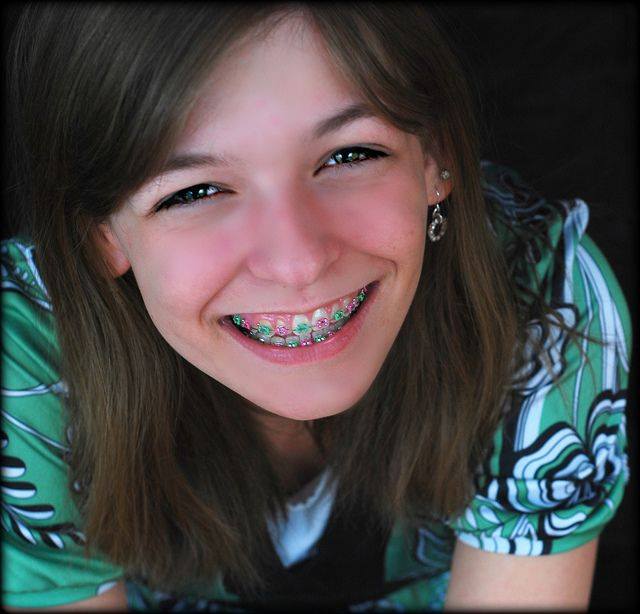 Địa chỉ niềng răng đẹp và uy tín nhất Kon Tum