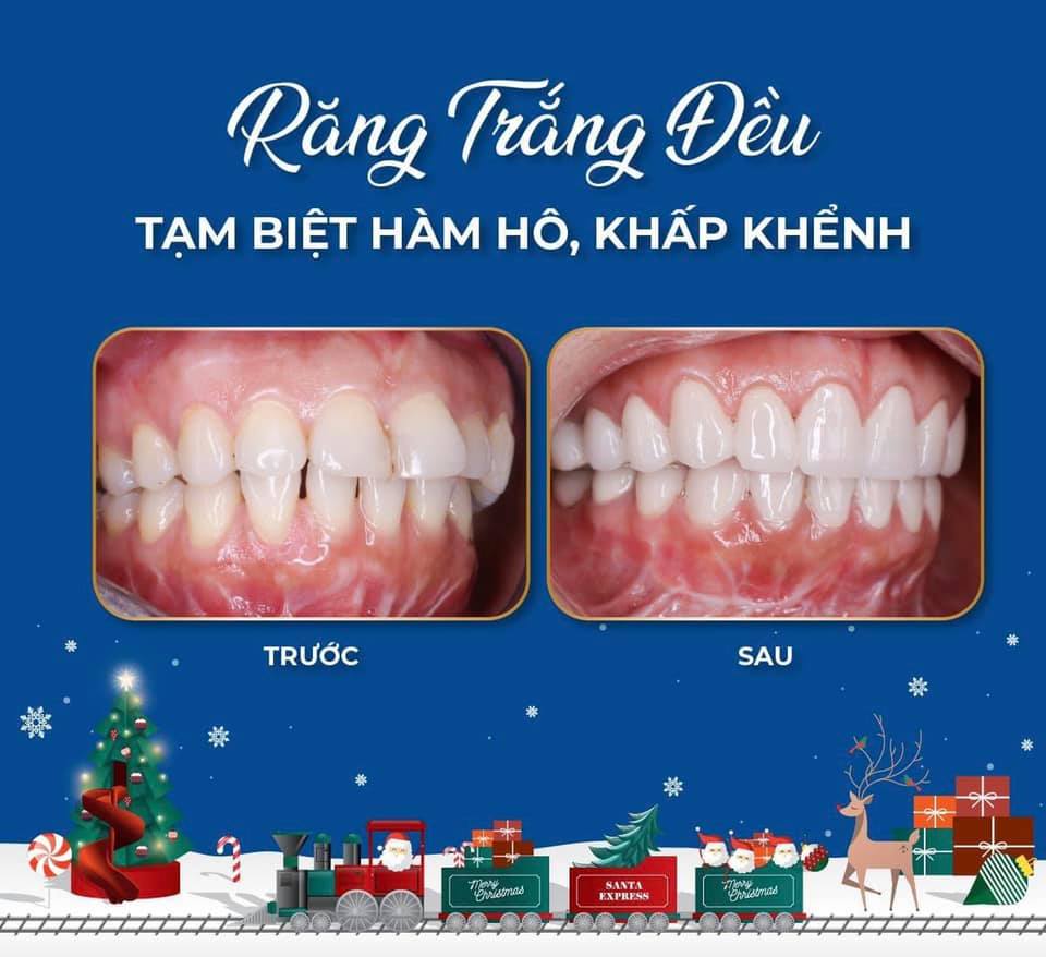 Nha Khoa Việt Tiên Sài Gòn ảnh 1