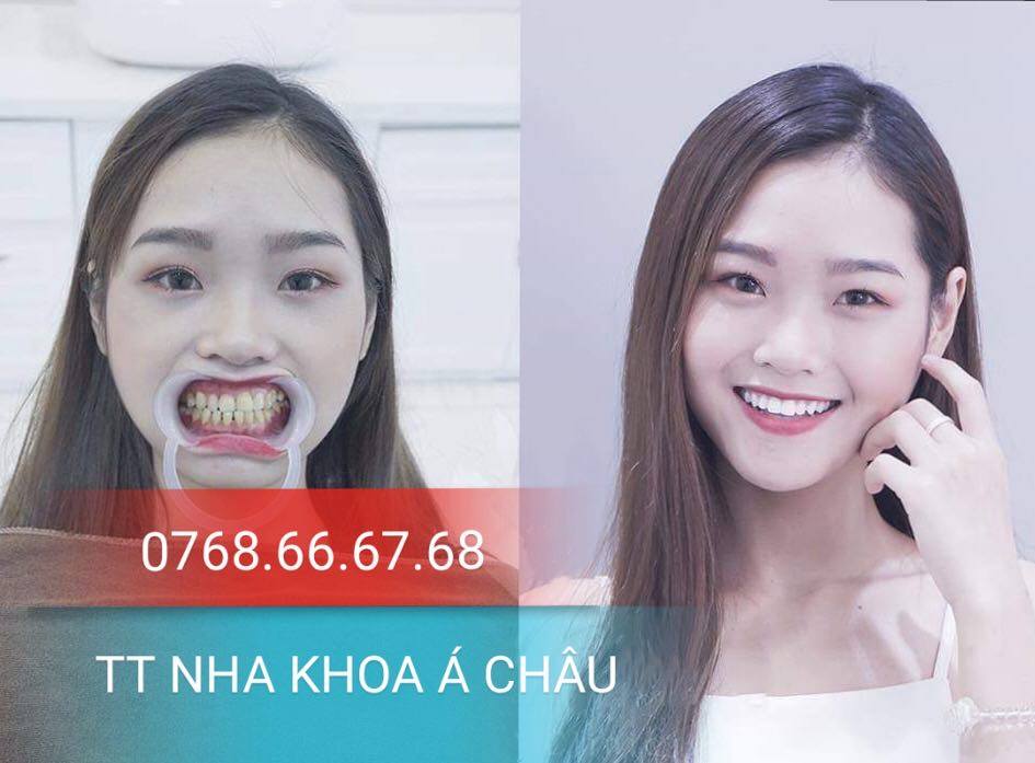 Nha khoa Á Châu Vũng Tàu ảnh 1