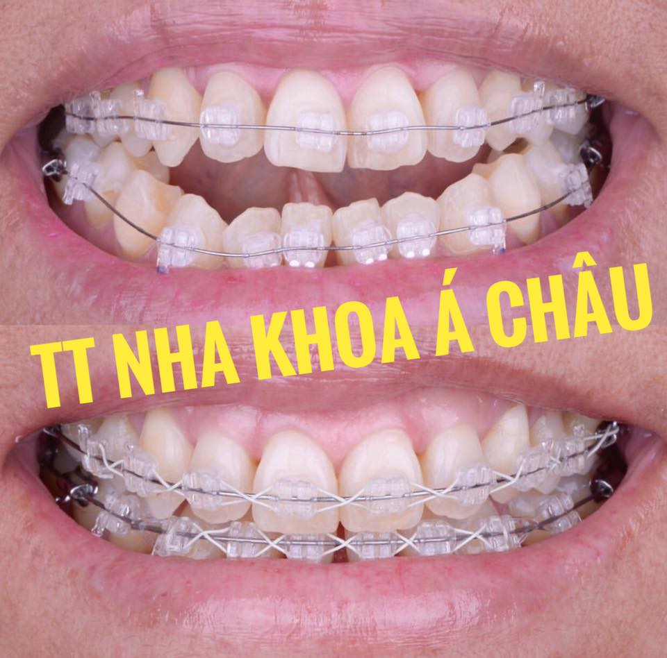 Nha khoa Á Châu Vũng Tàu ảnh 2
