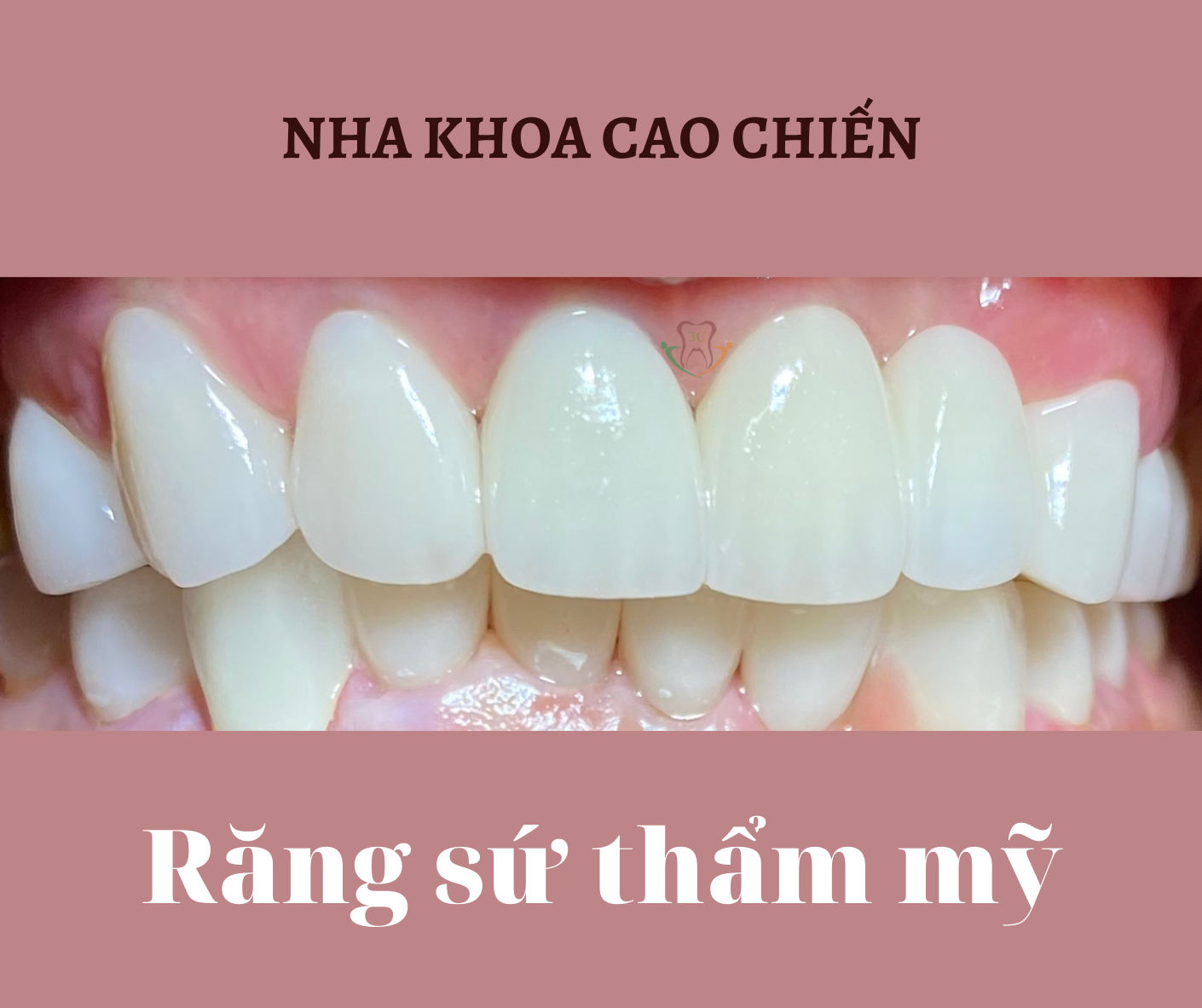 Nha khoa Cao Chiến ảnh 2