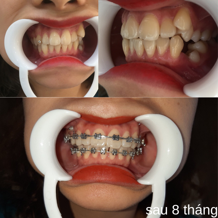 Nha khoa Dr Smile- Hải Dương ảnh 2