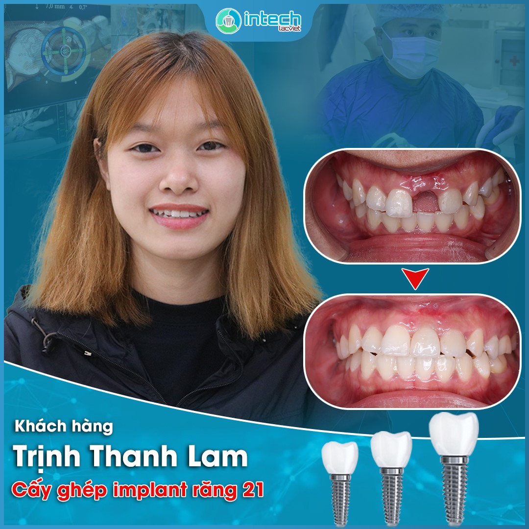 Nha khoa Lạc Việt Intech ảnh 1