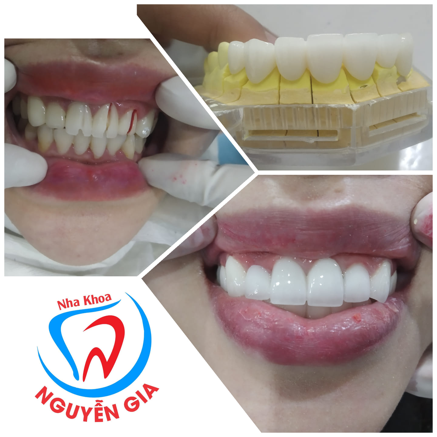 Nha khoa Nguyễn Gia ảnh 1