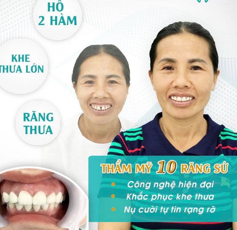 Nha khoa Nụ Cười Cà Mau ảnh 1