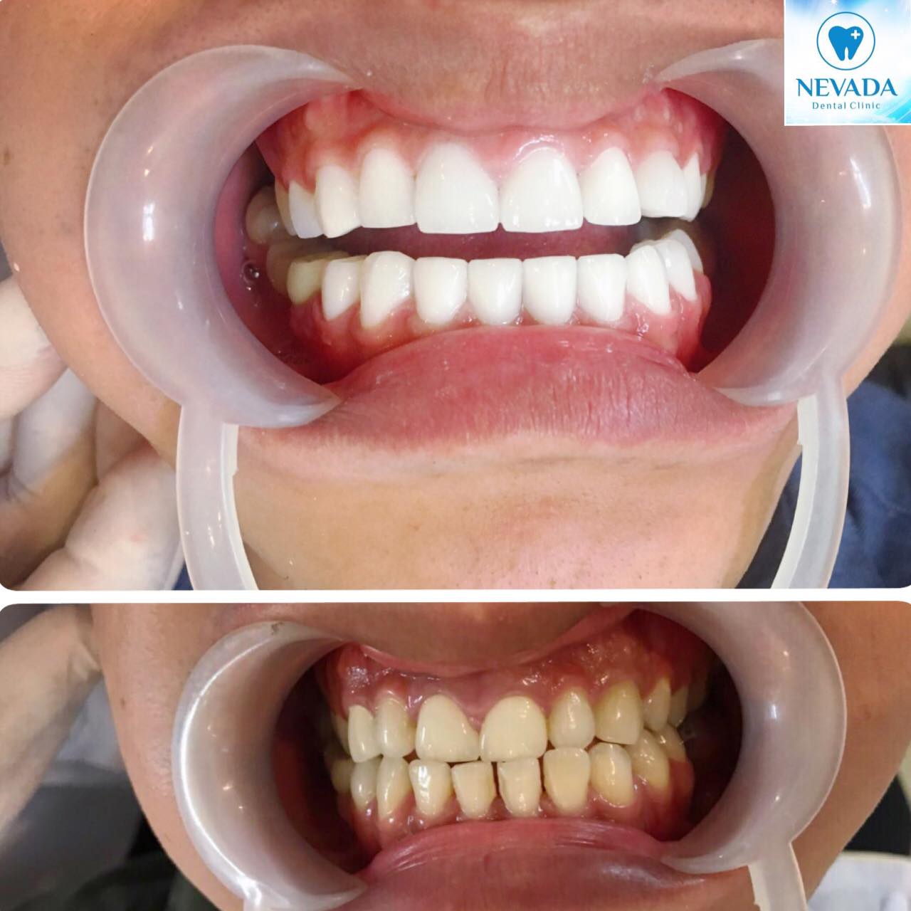 Nha khoa Quốc Tế Nevada ảnh 1