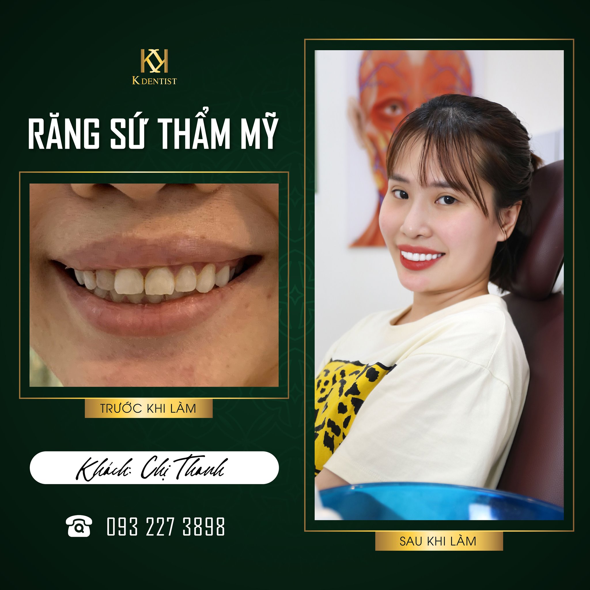 Nha khoa Quốc tế K Dentist - Quảng Ngãi ảnh 1