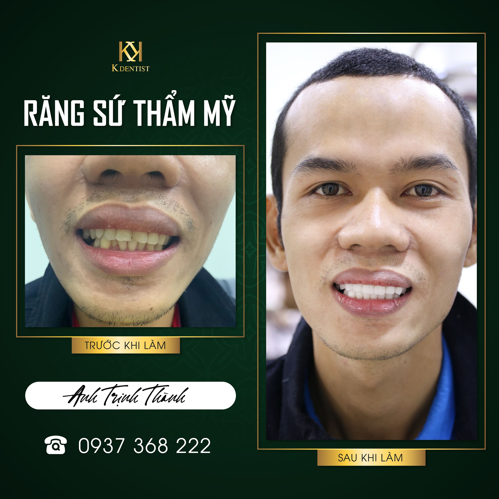 Nha khoa Quốc tế K Dentist - Quảng Ngãi ảnh 2