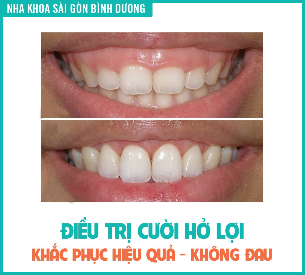 Nha khoa Sài Gòn Bình Dương ảnh 2