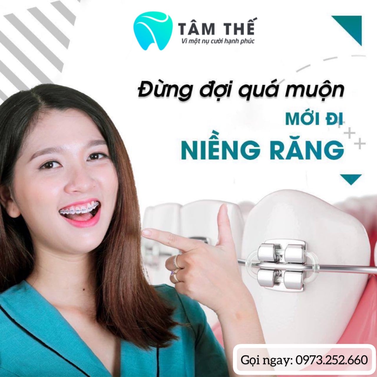 Địa chỉ niềng răng uy tín nhất Đà Lạt