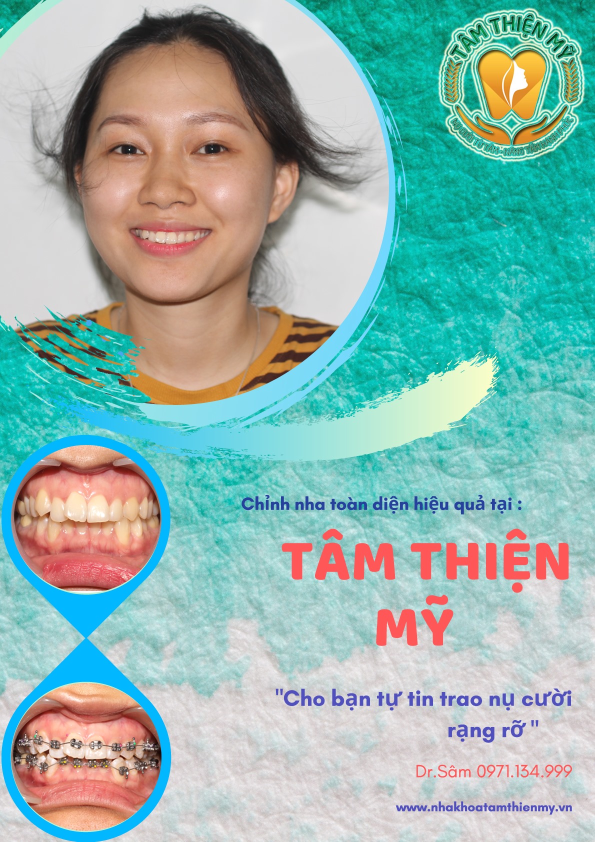 Nha khoa Tâm Thiện Mỹ ảnh 1