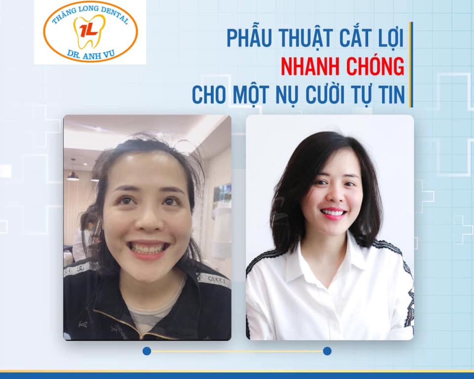 Nha khoa Thăng Long - BS Nguyễn Anh Vũ ảnh 3