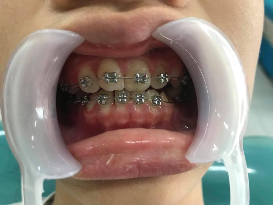 Nha khoa Việt Anh ảnh 1