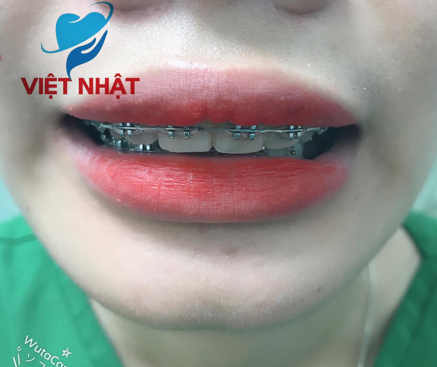 Nha khoa Việt Nhật ảnh 2