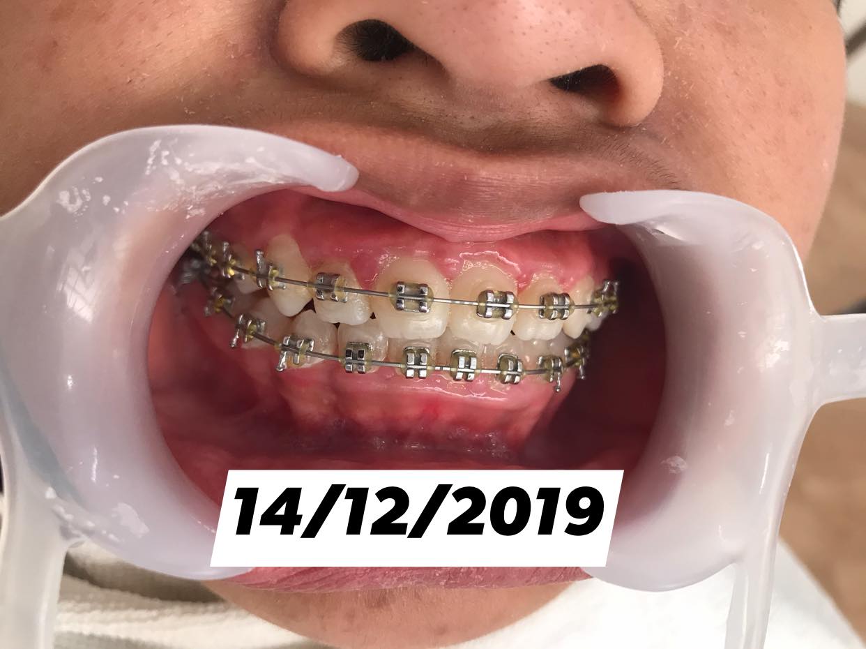 Nha khoa minh đức ảnh 2