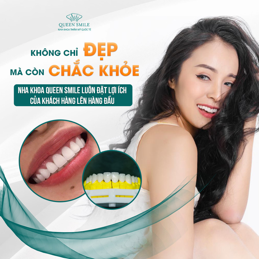 Nha khoa thẩm mỹ Queen Smile ảnh 2