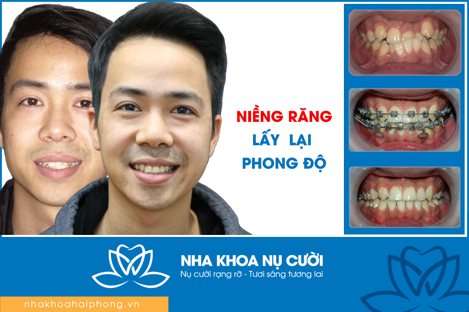 Nha Khoa Nụ Cười Hải Phòng ảnh 1