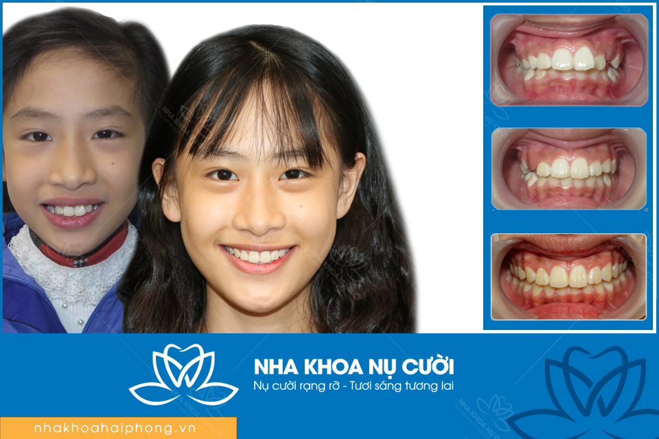 Nha Khoa Nụ Cười Hải Phòng ảnh 2