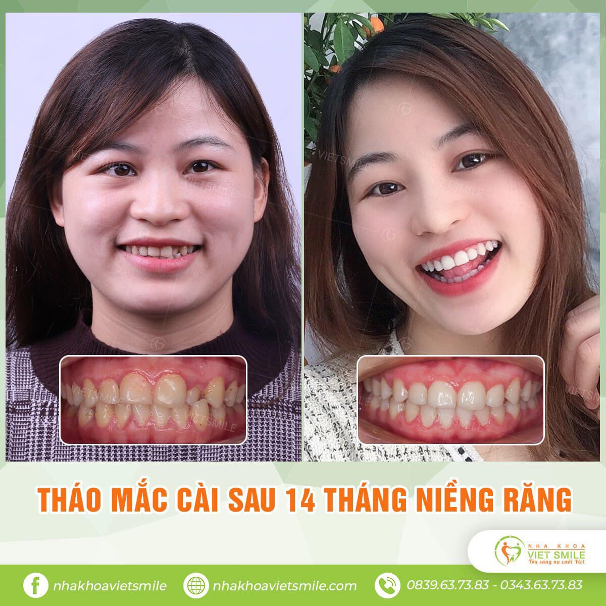 VIET SMILE - Viện Thiết Kế Nụ Cười 4.0 ảnh 2