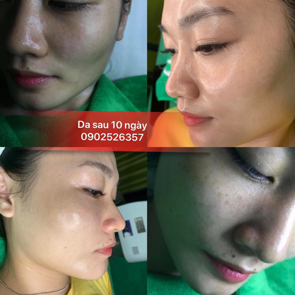 Bảo Vy Spa ảnh 2