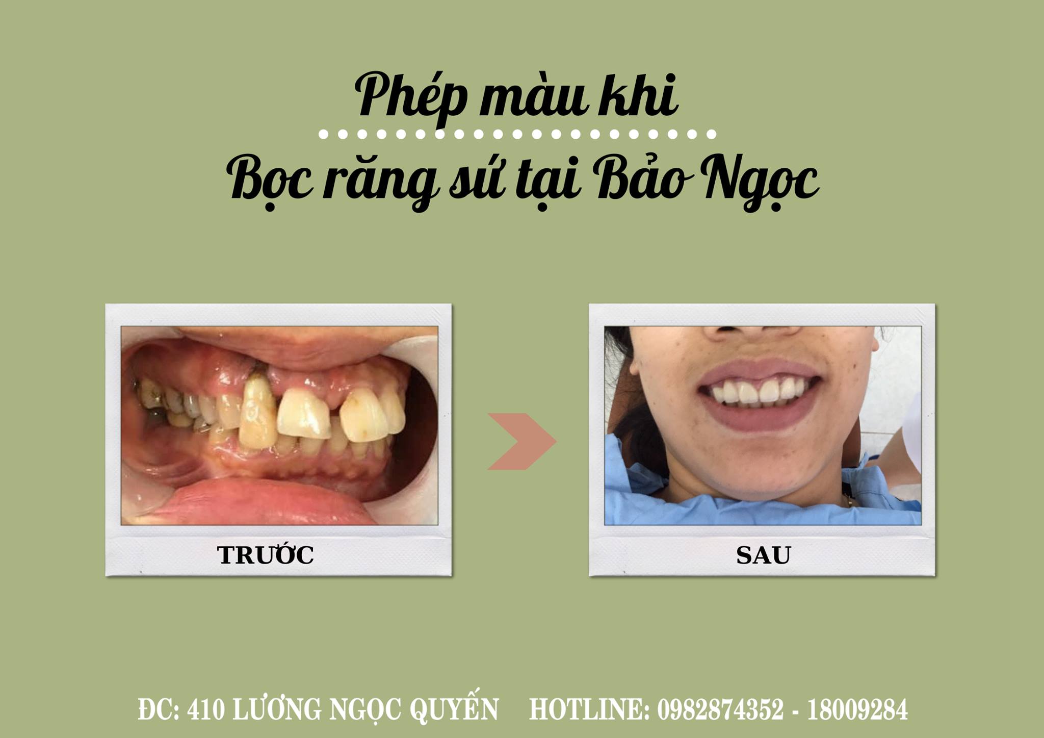 NHA KHOA BẢO NGỌC ảnh 2