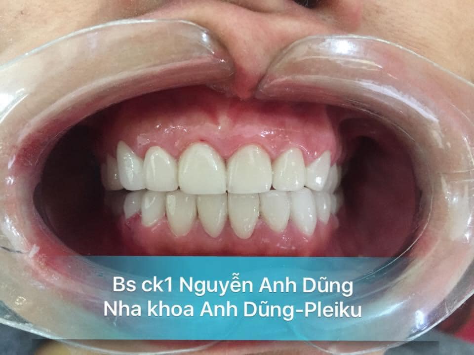 Nha Khoa Anh Dũng ảnh 2