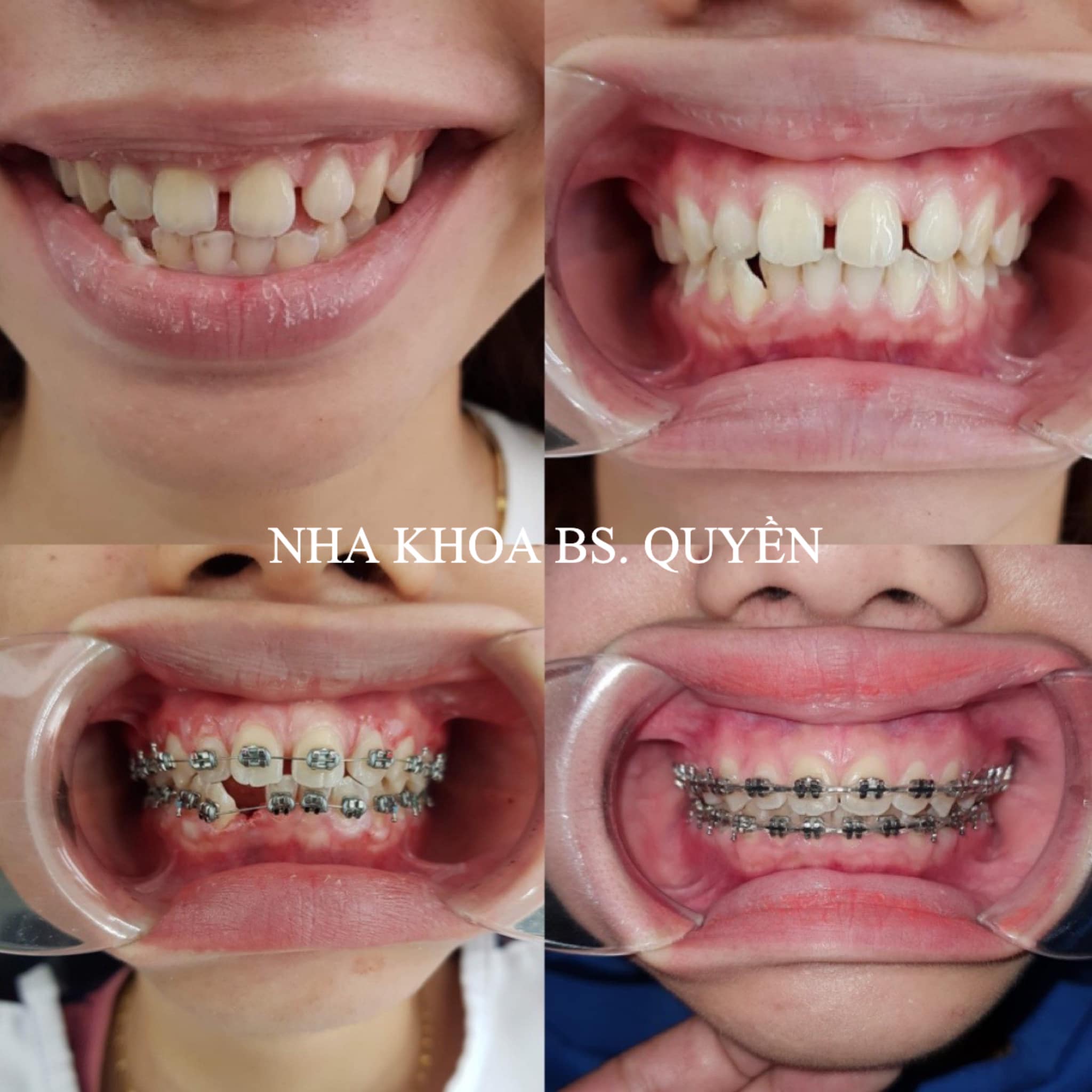 Nha Khoa Bác Sĩ Quyền ảnh 1