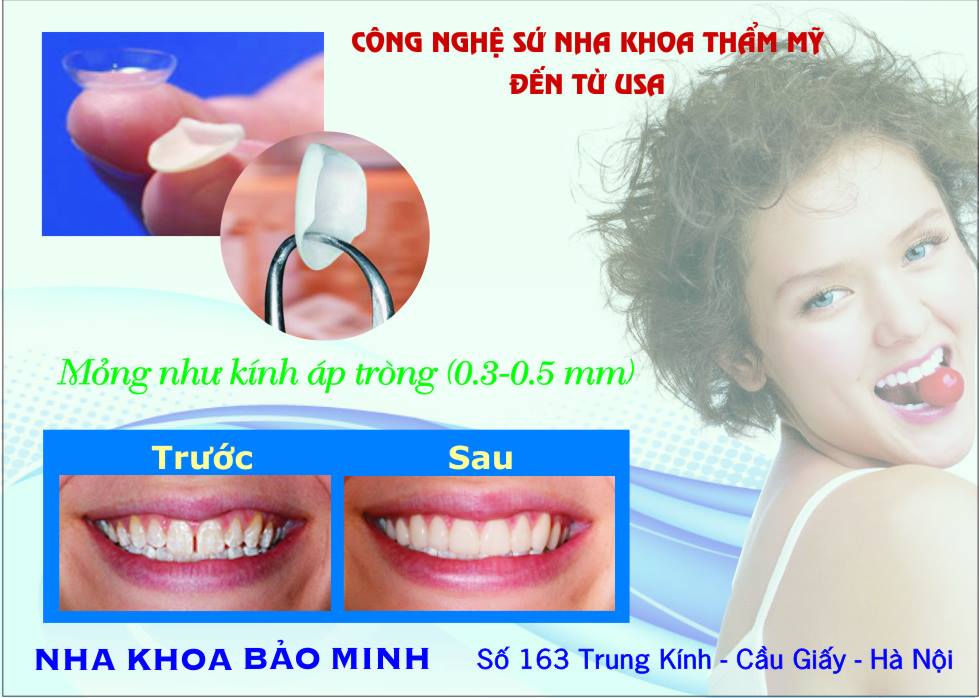 Nha Khoa Bảo Minh ảnh 1