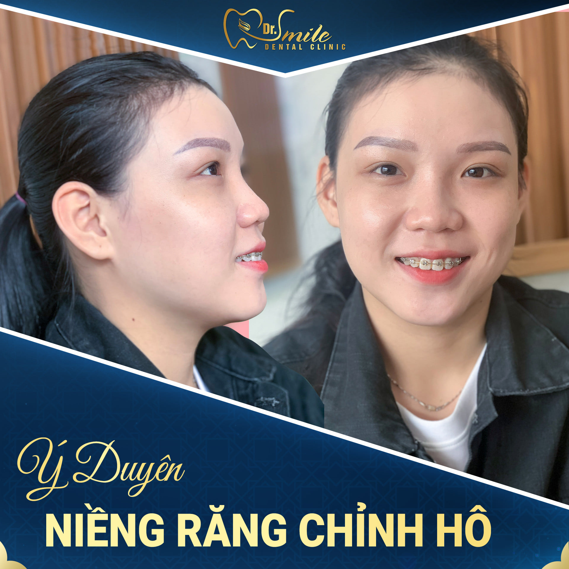 Nha Khoa Dr.Smile ảnh 1