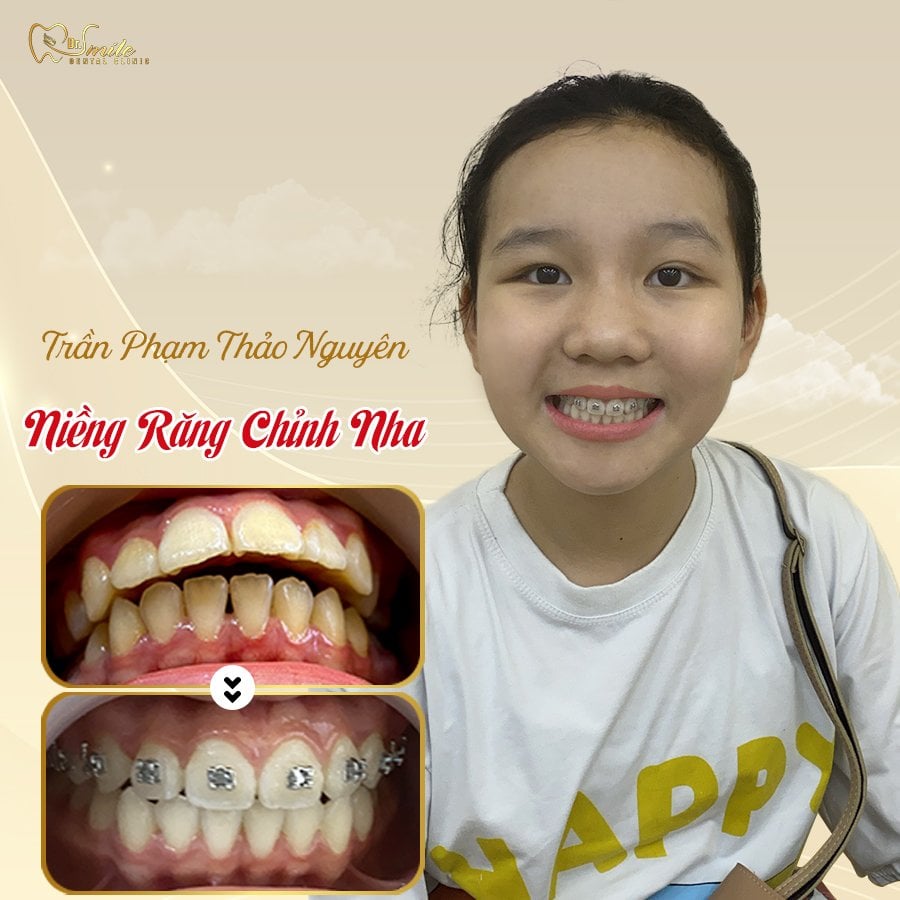 Nha Khoa Dr.Smile ảnh 2