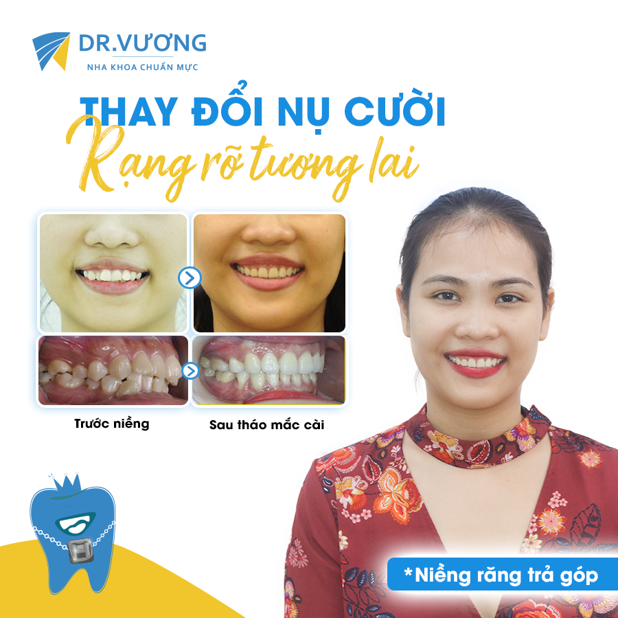 Nha Khoa Dr Vương ảnh 1