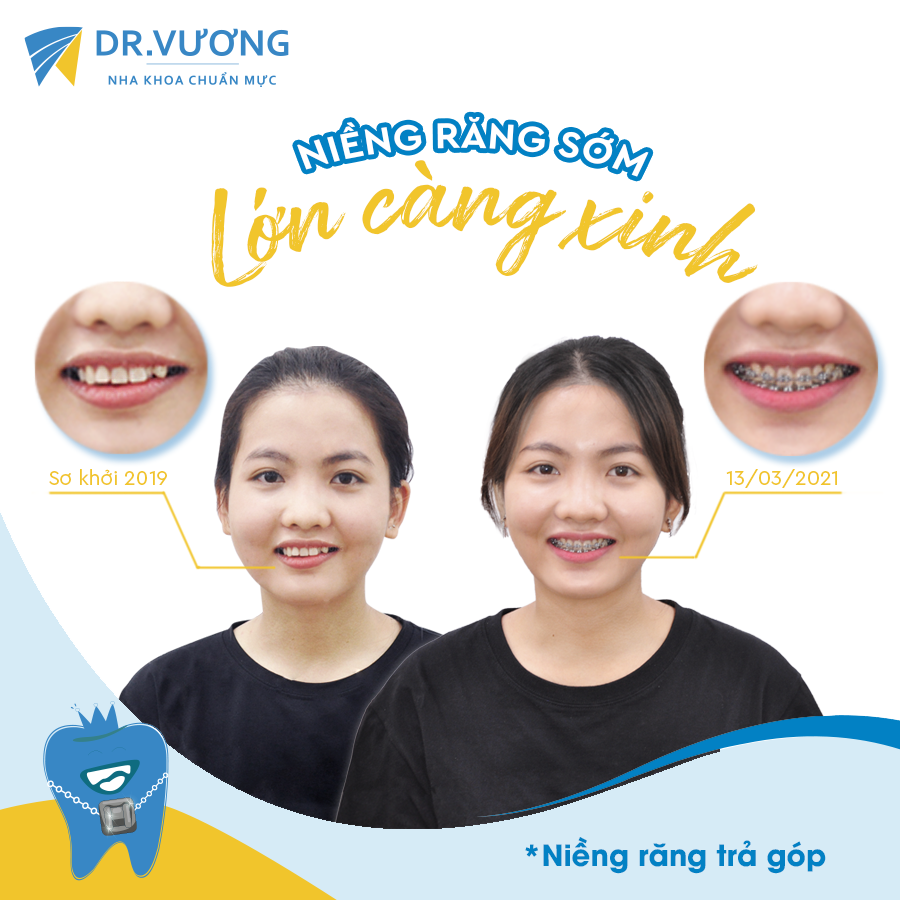 Nha Khoa Dr Vương ảnh 2