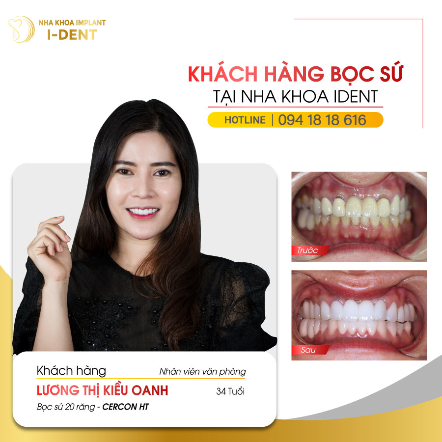 Nha Khoa I-Dent ảnh 1